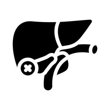 Cholecystectomy surgery glyph icon vector illustration Stock Illustration