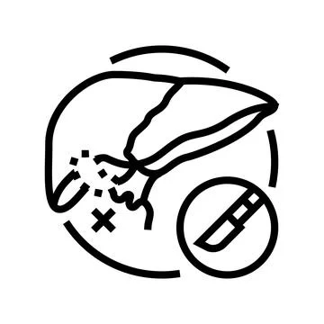 Cholecystectomy surgery line icon vector illustration Stock Illustration