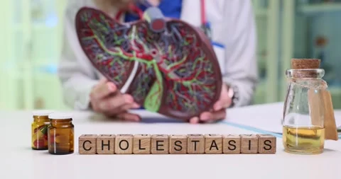 Cholestasis A Comprehensive Guide to Understanding Liver Function and Overall Stock Footage 312173531