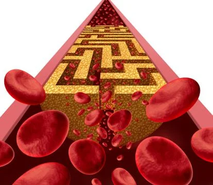 Cholesterol Disease Challenge Иллюстрация
