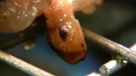 Cholesterol Stock-Footage 8951625