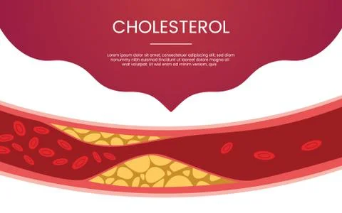 Cholesterol human vein concept theme for template banner or landing homepage  Illustrazione stock