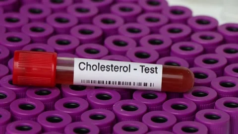 Cholesterol test to look for abnormaliti... | Stock Video | Pond5