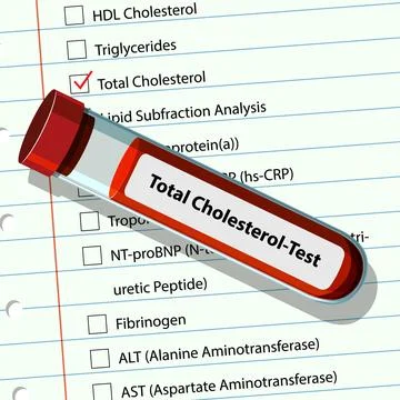 Cholesterol Test Vector Illustration Stock Illustration