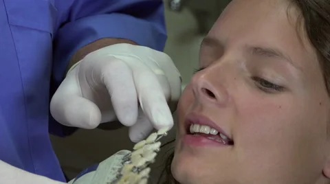 Choosing the color of teeth Video stock 53010552