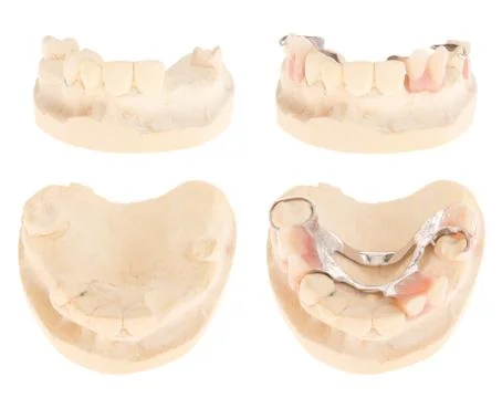 Chrome cobalt denture Stock Photos