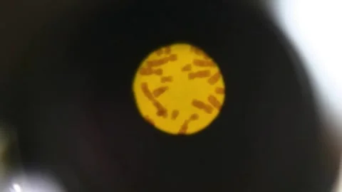 Chromosomes in the eyepiece of a microscope. 스톡 동영상 269022804