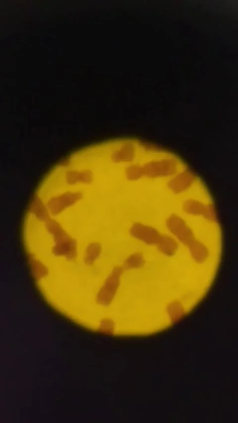 Chromosomes in the eyepiece of a microscope. Vertical video. Stock Footage 269041375