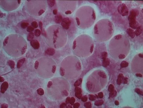 Chromosomes in the nucleus of a cell Stock Photos