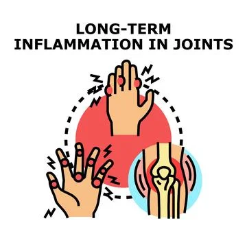 Chronic joint inflammation causing pain and discomfort Illustrazione stock