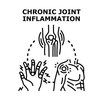 Chronic joint inflammation causing pain and discomfort vector Stock Illustration