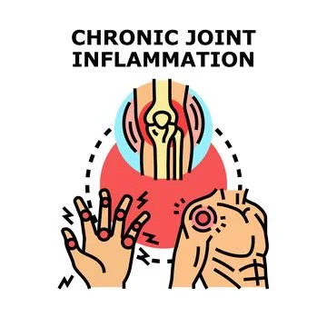 Chronic joint inflammation causing pain and discomfort vector Stock Illustration