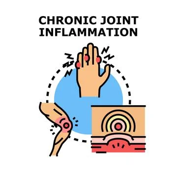 Chronic joint inflammation causing pain in human joints Illustrazione stock