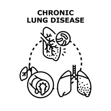 Chronic lung disease medical problem illustration Stock Illustration