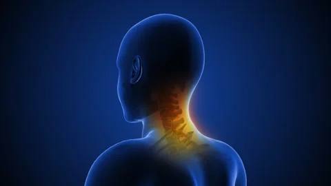 Chronic Neck Pain Caused by Poor Posture Stock-Footage 296480292