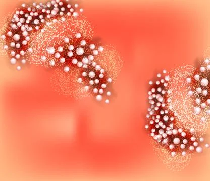 Chronic persistent acrodermatitis, psoriasis of the palms and soles. texture Stock Illustration