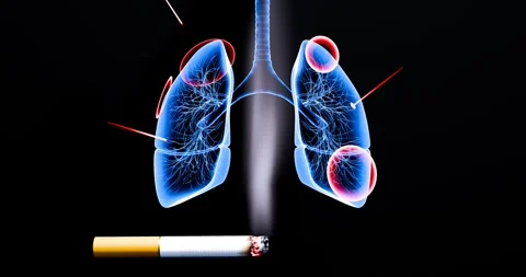 cigarettes with the least amount of tar New low-nicotine products coming soon – UW-CTRI – UW–Madison