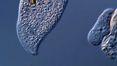 Ciliate and amoebae under microscopic view 400x 库存影片 310314413