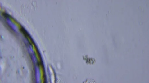 Ciliate and bacteria under Bright field Microscope 스톡 동영상 80253765