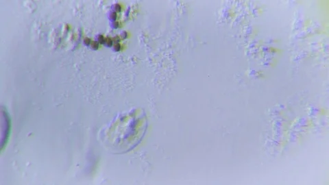 Ciliate and bacteria under Oblique light Microscope 스톡 동영상 80252385