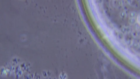 Ciliate and bacteria under Phase contrast Microscope Video stock 80249089