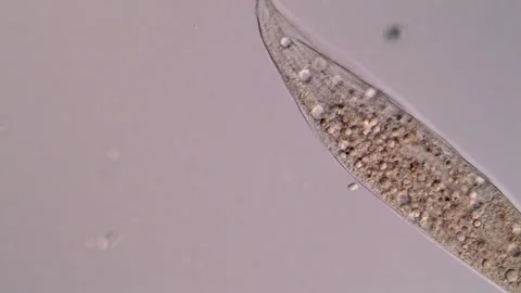 Ciliate ciliophora 库存影片 310645807