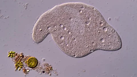 Ciliate ciliophora under microscopy view 库存影片 310642952
