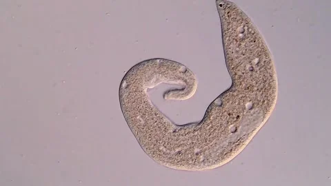 Ciliate microorganism 库存影片 310644892