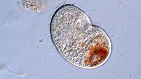 Ciliate Microorganisms Moving Rapidly Under Laboratory Microscope Stock-Footage 318945107