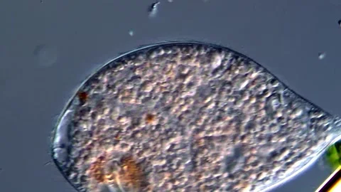 Ciliate (microscopy view 400x) 库存影片 310648194