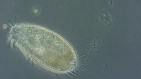 Ciliate moves in water. Stock Footage 324564434