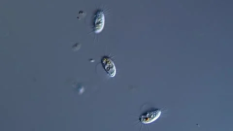 Ciliate in pond water under microscope 库存影片 310649748