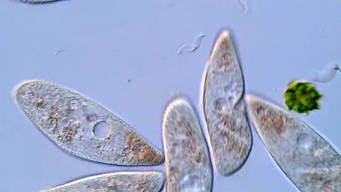 Ciliate Protozoa Floating Among Algae and Bacteria Vidéo 318001827