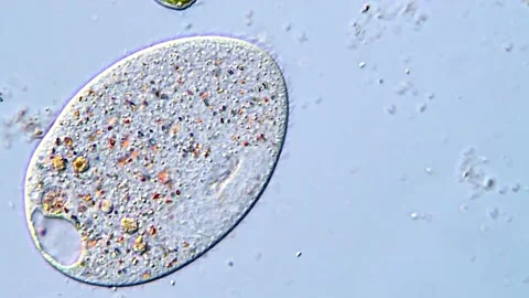 Ciliate Protozoa Observed Under DIC Contrast Microscopy Vídeos de archivo 318002408