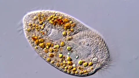 Ciliate Protozoa under DIC microscope, 400x magnification 스톡 동영상 317171035