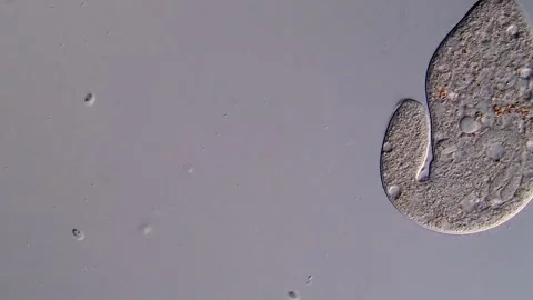 Ciliate protozoan 库存影片 310645993
