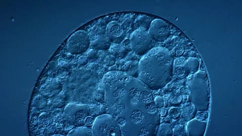 Ciliate protozoan under microscopy view Vidéo 306578901