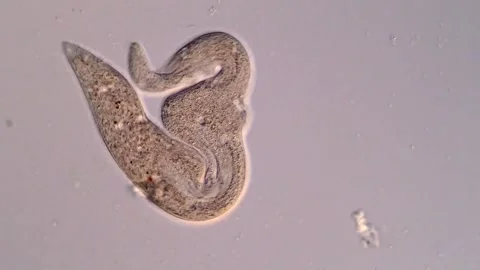 Ciliate protozoan under microscopy view 库存影片 310644772