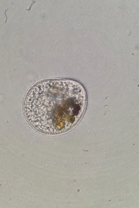 Ciliate Specimen at 100x under Brightfield Microscopy Stock Footage 334465189