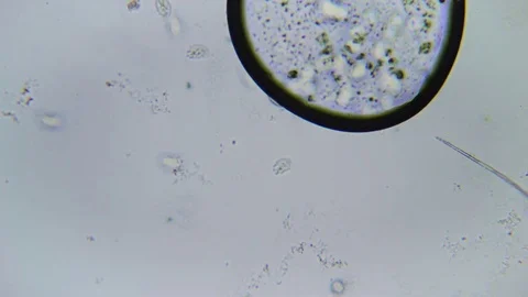 Ciliate under Bright field Microscope 스톡 동영상 80253938