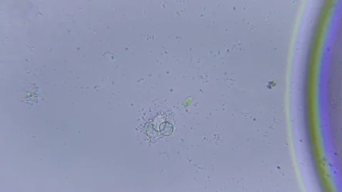 Ciliate under Bright field Microscope Video stock 80387483