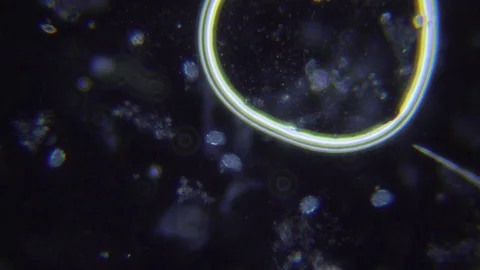 Ciliate under Dark field Microscope Video stock 80251329