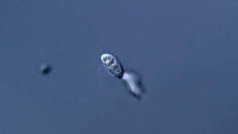 Ciliate under the microscope 库存影片 310314130