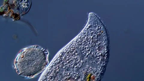 Ciliate under microscopy view 400x magnification 스톡 동영상 310314297