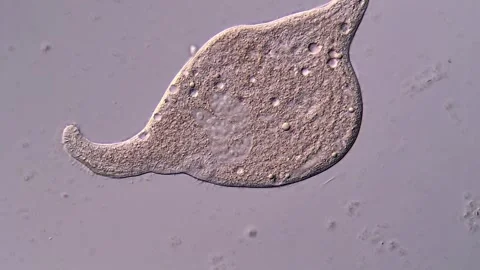 Ciliate under microscopy view 400x magnification 库存影片 310642146