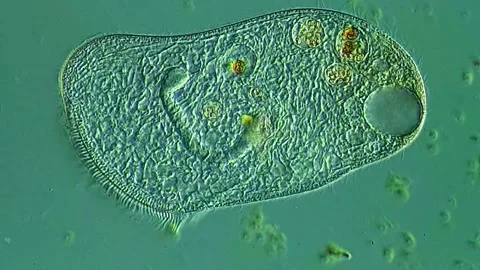 Ciliate under microscopy view 库存影片 306586704