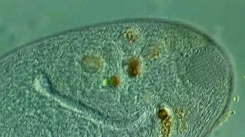 Ciliate under microscopy view 库存影片 306591035