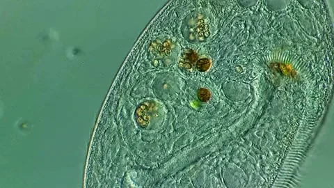 Ciliate under microscopy view Vidéo 306591150