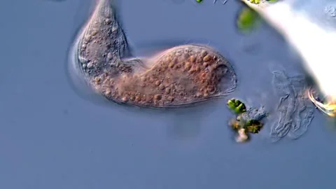 Ciliate under microscopy view 库存影片 310312414