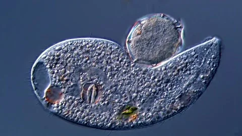 Ciliate under microscopy view Vidéo 310314562